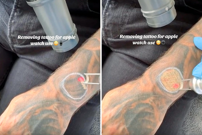 Man removes part of tattoo sleeve to wear Apple Watch